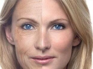 အရေပြားအရောင်ခြယ်ခြင်း။