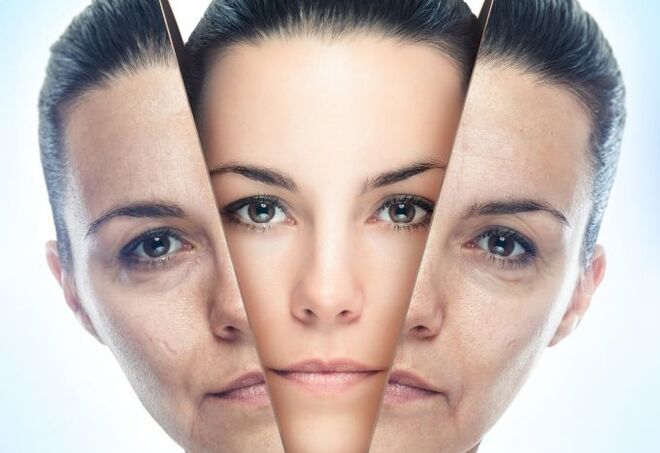 အသက်အရွယ်နဲ့ဆိုင်တဲ့ ပြောင်းလဲမှုတွေကနေ မျက်နှာအသားအရေကို ဖယ်ရှားတဲ့ လုပ်ငန်းစဉ်